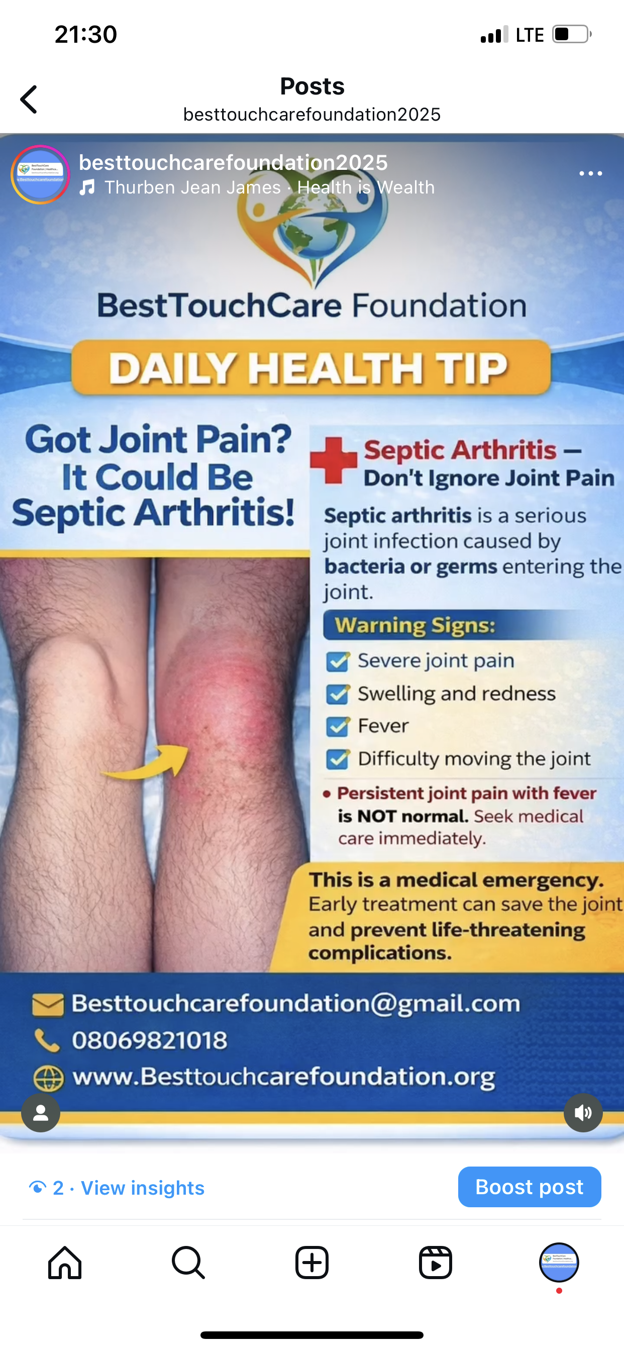 Septic Arthritis is real