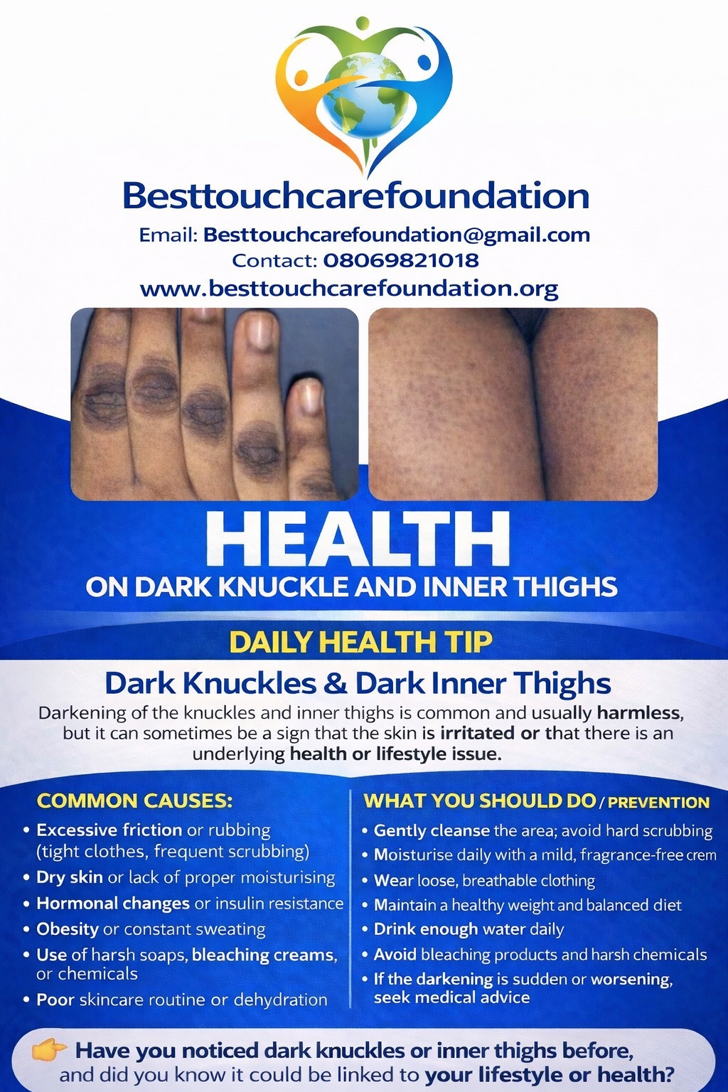 Gentle care today can protect your skin tomorrow