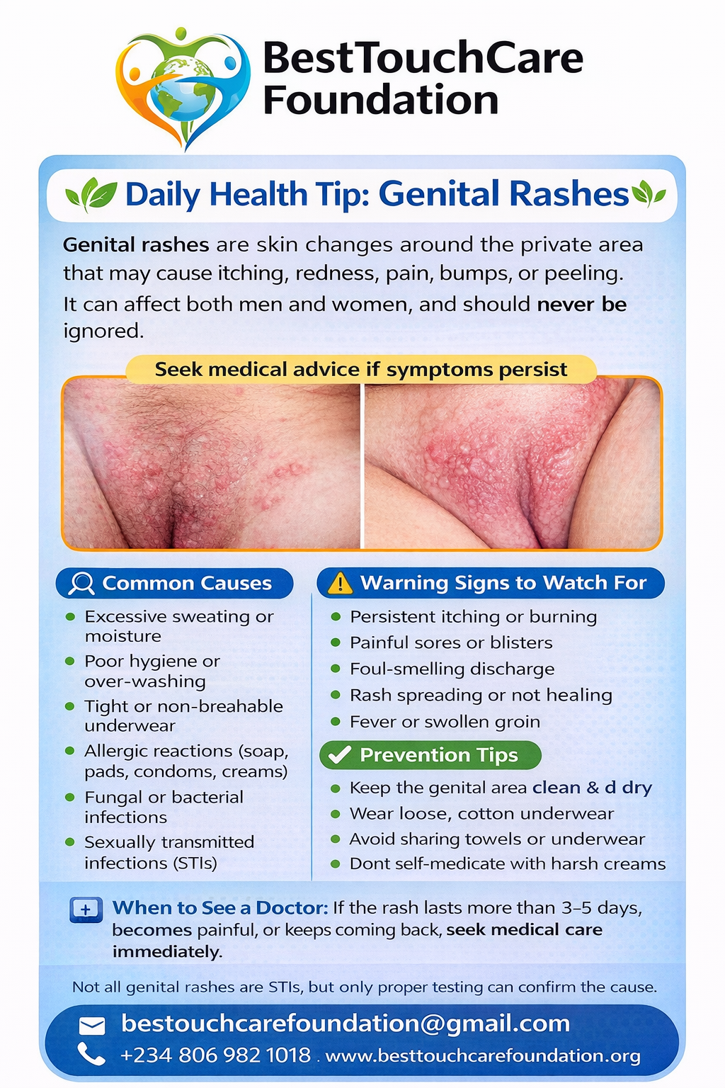 Genital rashes are not a sign of being dirty.